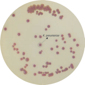 克雷伯菌显色培养基