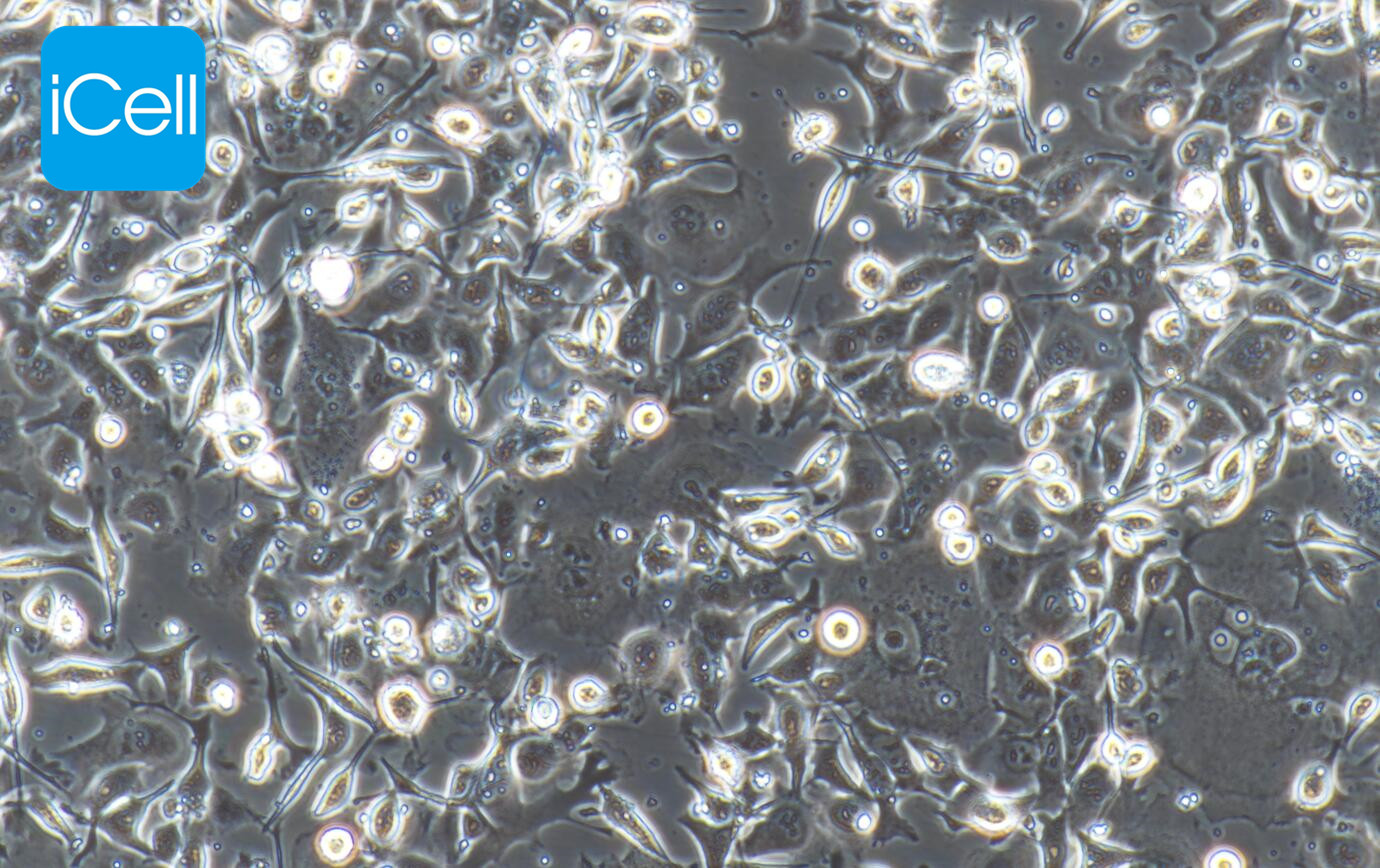 HCT-15细胞/HCT15细胞/HCT-15/HCT15/人结肠癌细胞