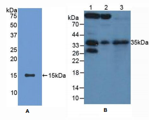 https://msimg.bioon.com/bionline/goods-no-pic.png