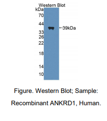 人锚定蛋白重复域蛋白1(ANKRD1)多克隆抗体