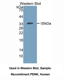 https://msimg.bioon.com/bionline/goods-no-pic.png