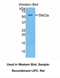 https://msimg.bioon.com/bionline/goods-no-pic.png