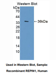 人复制启动因子1(REPIN1)多克隆抗体