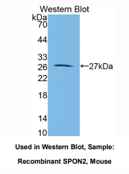 https://msimg.bioon.com/bionline/goods-no-pic.png