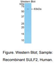 https://msimg.bioon.com/bionline/goods-no-pic.png