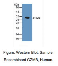 人颗粒酶B(GZMB)多克隆抗体