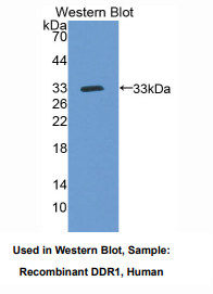 https://msimg.bioon.com/bionline/goods-no-pic.png