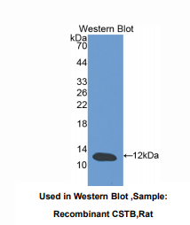 https://msimg.bioon.com/bionline/goods-no-pic.png