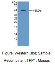 https://msimg.bioon.com/bionline/goods-no-pic.png