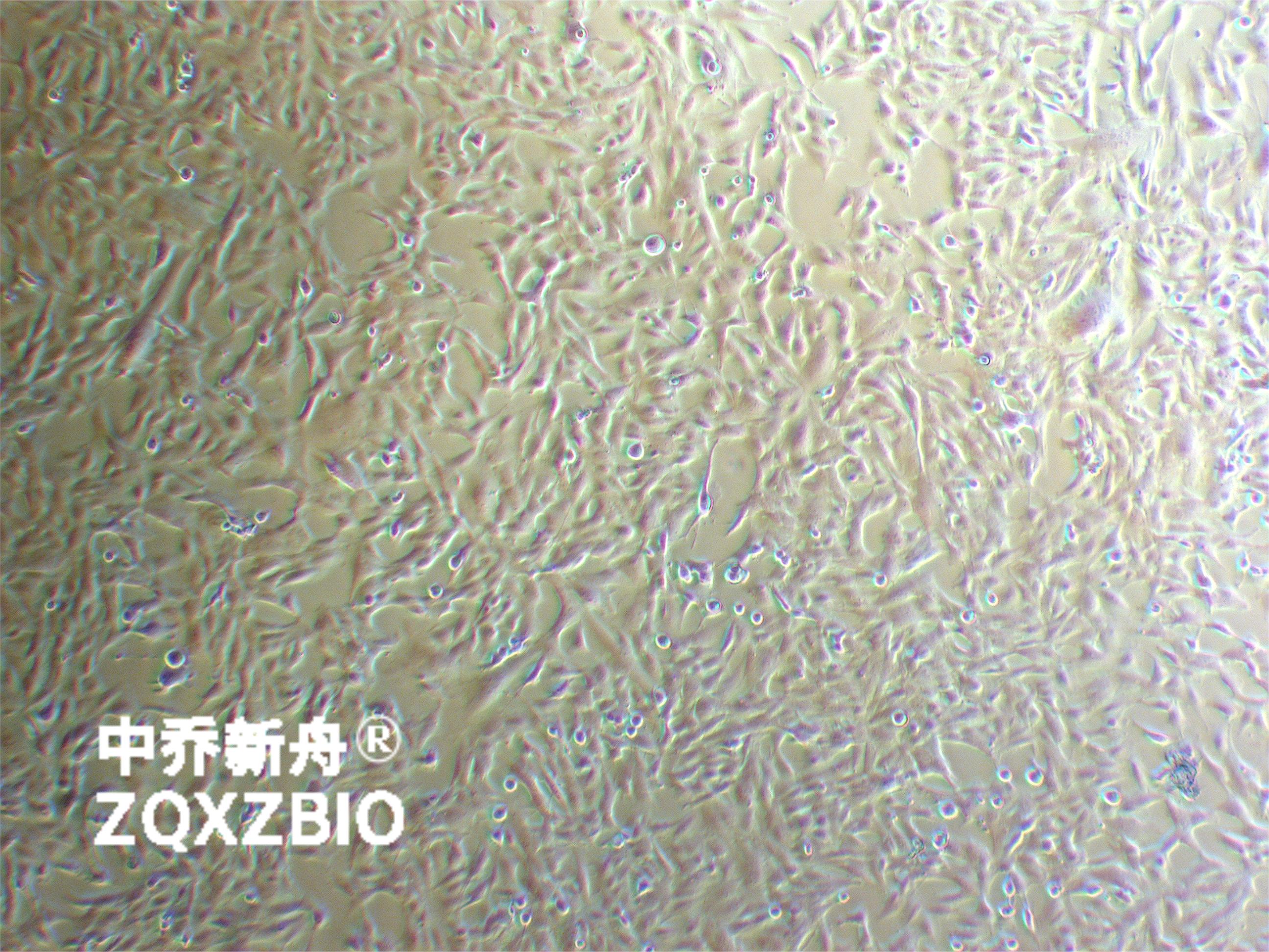 U251MG/TMZ 人类星形胶质瘤耐替莫唑胺细胞