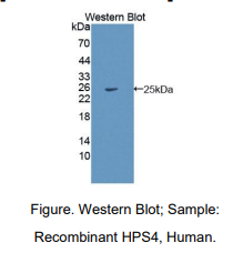 人赫曼斯基普德拉克综合征蛋白4(HPS4)多克隆抗体
