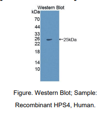 https://msimg.bioon.com/bionline/goods-no-pic.png