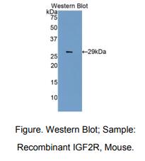 https://msimg.bioon.com/bionline/goods-no-pic.png