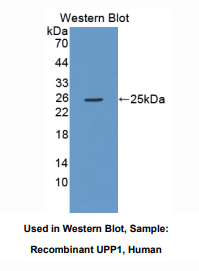 https://msimg.bioon.com/bionline/goods-no-pic.png