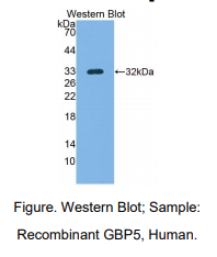 https://msimg.bioon.com/bionline/goods-no-pic.png