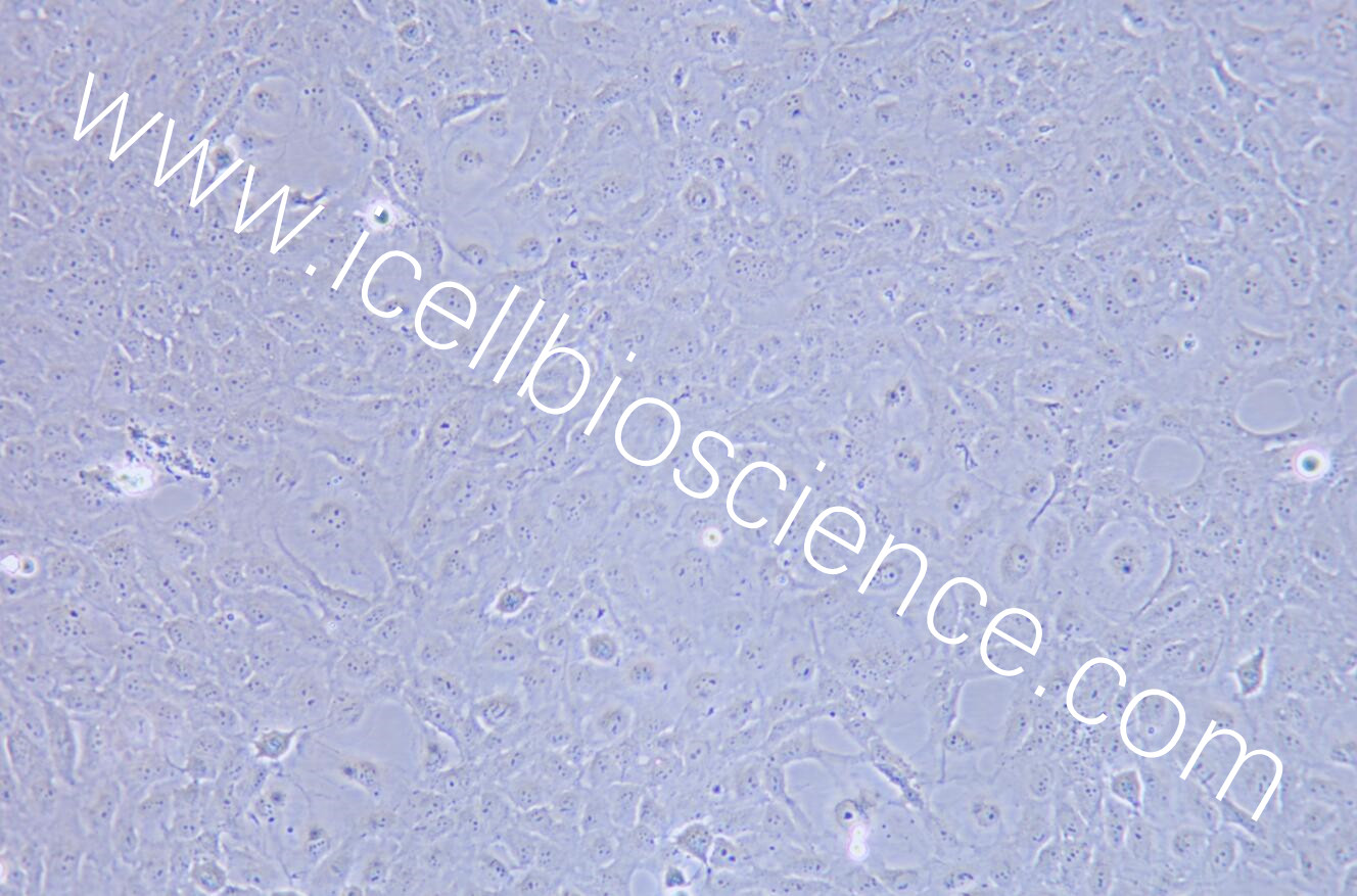 SRA01/04细胞/SRA01-04细胞/SRA0104细胞/SRA01-04/SRA01-04/人晶体上皮细胞