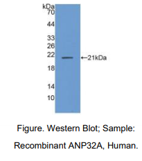 人酸性核磷蛋白32A(ANP32A)多克隆抗体