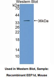 小鼠真核翻译延伸因子1δ(EEF1d)多克隆抗体