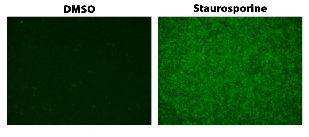 https://img.medsci.cn/e73eefcea40976357f460123cbf1e819c54e5106c9b457225be13b1cbc991aff.png