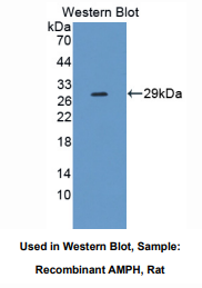 大鼠两性蛋白(AMPH)多克隆抗体