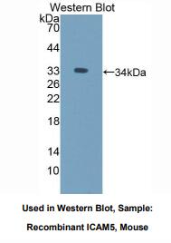 小鼠细胞间粘附分子5(ICAM5)多克隆抗体