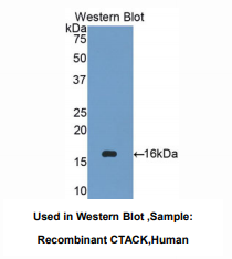 https://msimg.bioon.com/bionline/goods-no-pic.png