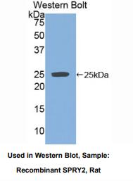 https://msimg.bioon.com/bionline/goods-no-pic.png