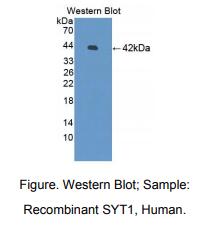 人突触囊泡蛋白Ⅰ(SYT1)多克隆抗体