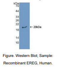 https://msimg.bioon.com/bionline/goods-no-pic.png