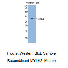 小鼠肌球蛋白轻链激酶3(MYLK3)多克隆抗体