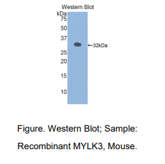 https://msimg.bioon.com/bionline/goods-no-pic.png