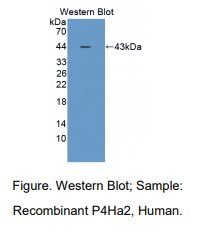 人脯氨酰4-羟化酶α多肽Ⅱ(P4Ha2)多克隆抗体
