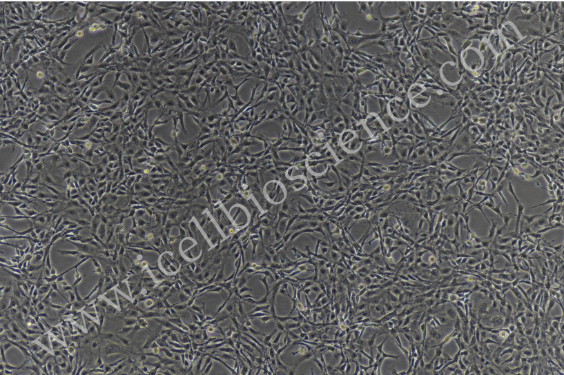 大鼠骨髓内皮细胞/大鼠原代骨髓内皮细胞/骨髓内皮细胞/小鼠骨髓内皮细胞
