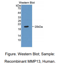 https://msimg.bioon.com/bionline/goods-no-pic.png