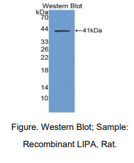 大鼠溶酶体酸脂肪酶A(LIPA)多克隆抗体