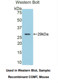 https://msimg.bioon.com/bionline/goods-no-pic.png