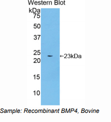 https://msimg.bioon.com/bionline/goods-no-pic.png