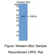 https://msimg.bioon.com/bionline/goods-no-pic.png