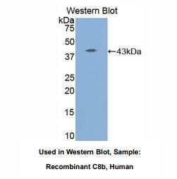 人补体成分8β(C8b)多克隆抗体