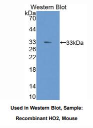 https://msimg.bioon.com/bionline/goods-no-pic.png