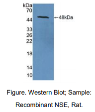 https://msimg.bioon.com/bionline/goods-no-pic.png