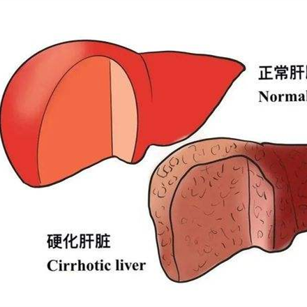 肝硬化动物模型  消化系统模型