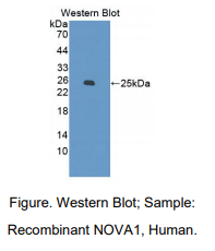 人神经肿瘤腹侧抗原1(NOVA1)多克隆抗体
