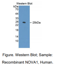 https://msimg.bioon.com/bionline/goods-no-pic.png