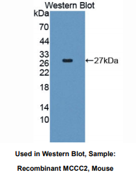 https://msimg.bioon.com/bionline/goods-no-pic.png