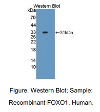 https://msimg.bioon.com/bionline/goods-no-pic.png