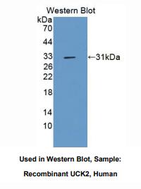 人尿苷胞苷激酶2(UCK2)多克隆抗体