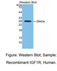 人胰岛素样生长因子1受体(IGF1R)多克隆抗体