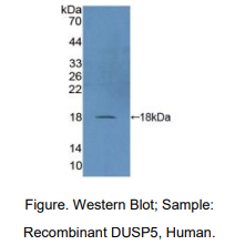 https://msimg.bioon.com/bionline/goods-no-pic.png