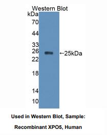 人输出蛋白5(XPO5)多克隆抗体